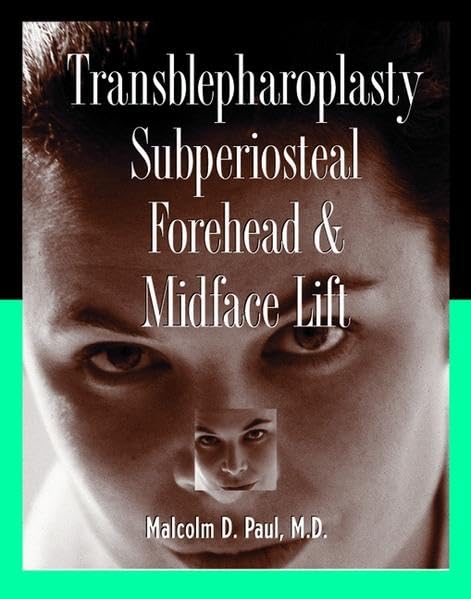 Transblepharoplasty subperiosteal forehead & midface lift by Malcolm D Paul