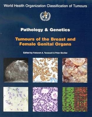 Pathology and Genetics of Tumours of the Breast and Female Genital Organs (IARC WHO Classification of Tumours)