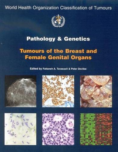 Pathology and Genetics of Tumours of the Breast and Female Genital Organs (IARC WHO Classification of Tumours) by The International Agency for Research on Cancer