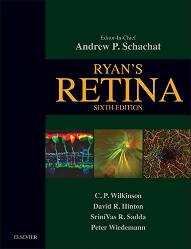 Algopix Similar Product 14 - Ryan's Retina E-Book