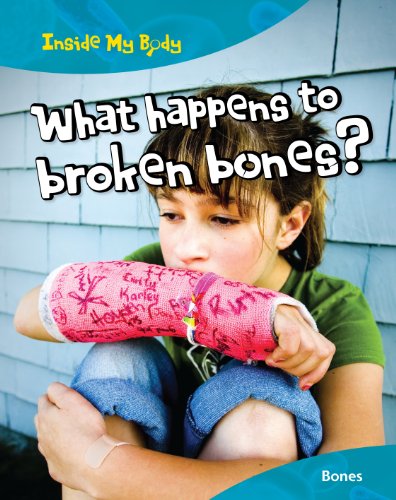 What Happens to Broken Bones? by Carol Ballard