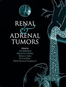 Renal and Adrenal Tumors: Biology and Management by Arie Belldegrun M.D.