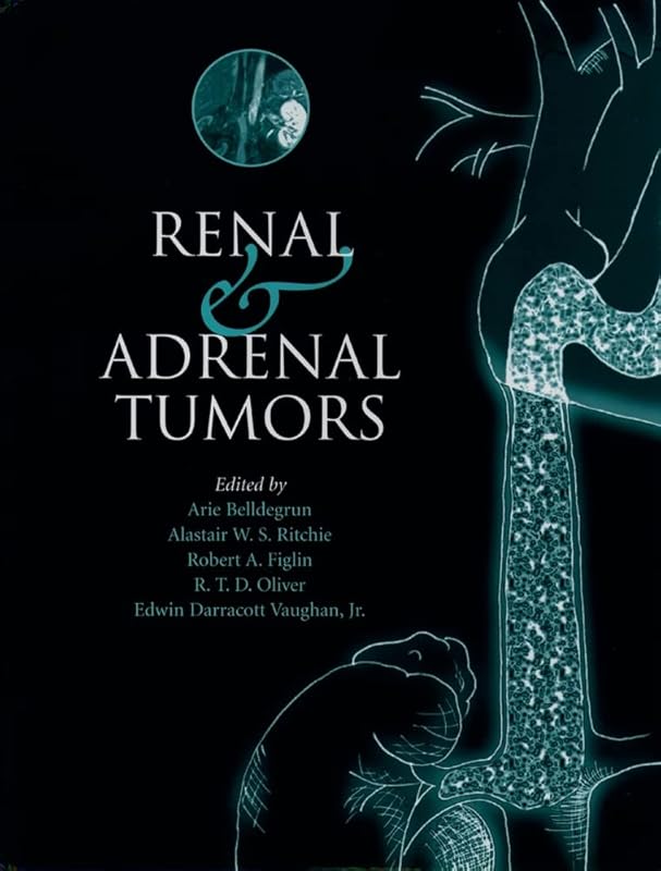 Renal and Adrenal Tumors: Biology and Management by Arie Belldegrun M.D.