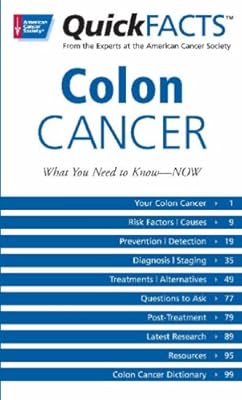 Quick Facts on Colon Cancer