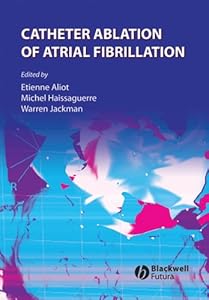 Catheter Ablation of Atrial Fibrillation by Etienne Aliot