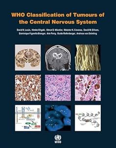 WHO Classification of Tumours of the Central Nervous System by International Agency for Research on Cancer