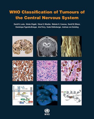 WHO Classification of Tumours of the Central Nervous System by International Agency for Research on Cancer