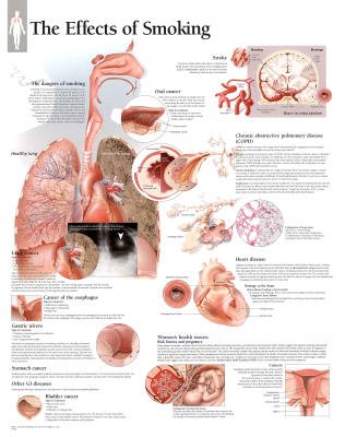 (22x28) Effects of Smoking Educational Chart Poster