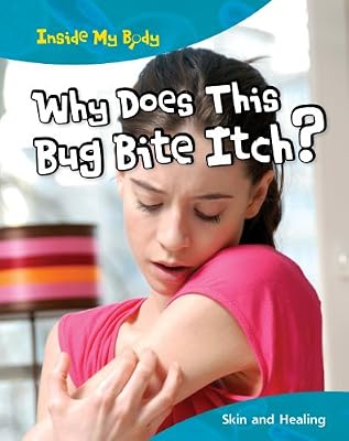 Why Does This Bug Bite Itch?: Skin and Healing