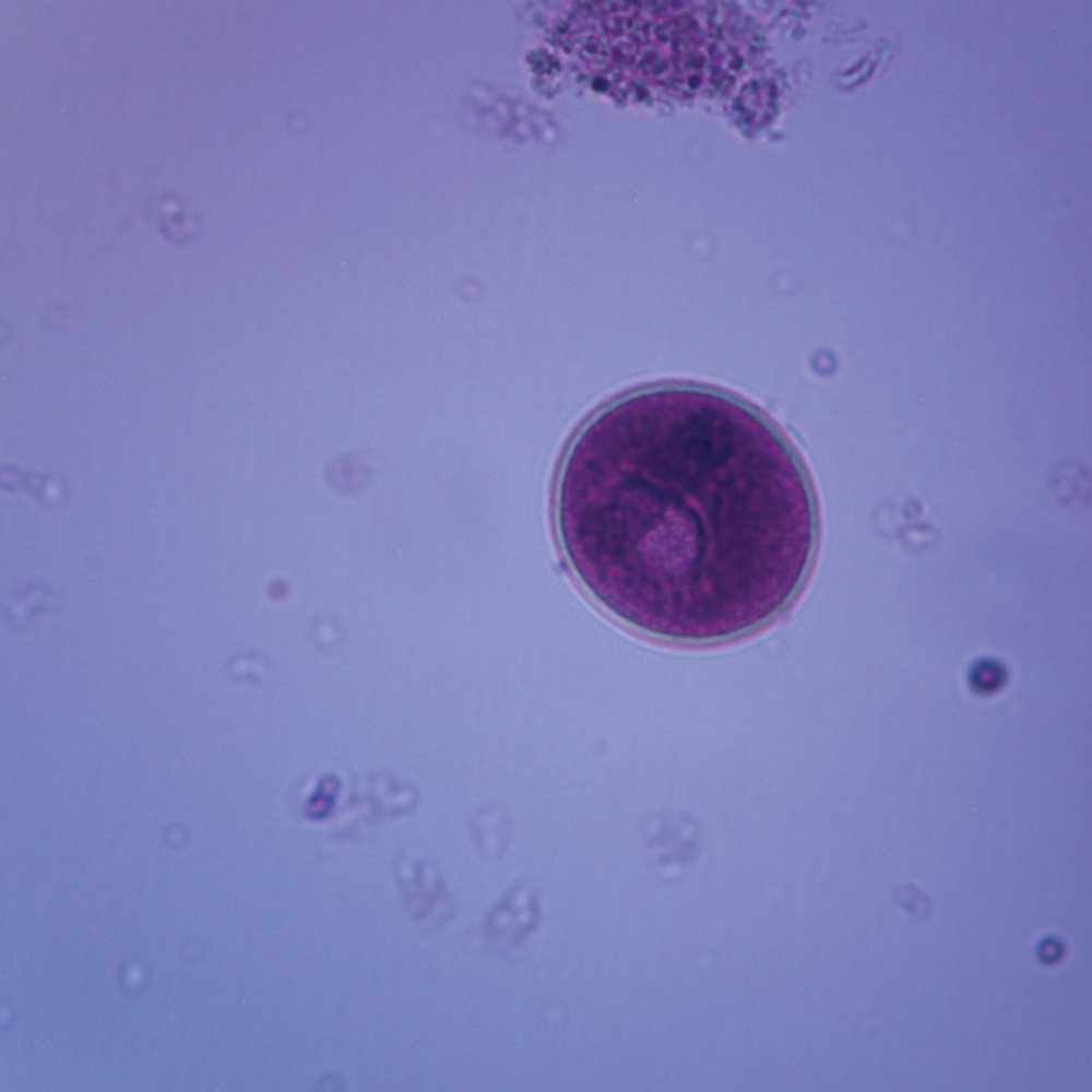

Balantidium coli Cysts, smear Microscope Slide