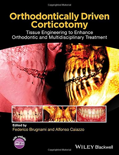 Minimally Invasive Spine Surgery (Minimally Invasive Procedures in Orthopaedic Surgery)
