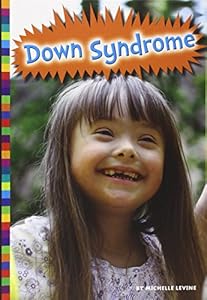 Down Syndrome