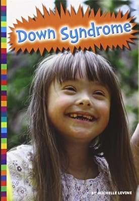 Down Syndrome