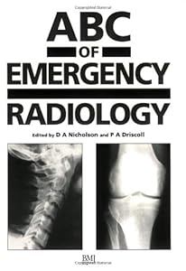 ABC of Emergency Radiology (ABC Series) by David A. Nicholson