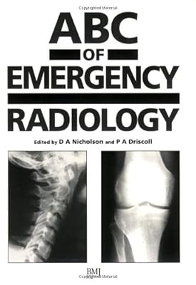 ABC of Emergency Radiology (ABC Series)