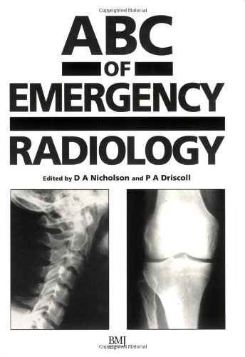 ABC of Emergency Radiology (ABC Series) by David A. Nicholson