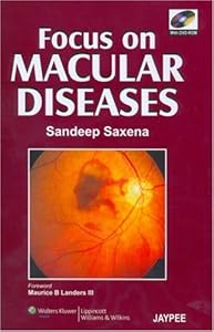 Focus on Macular Diseases by Sandeep Saxena