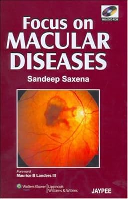Focus on Macular Diseases