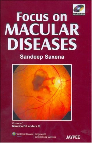 Focus on Macular Diseases by Sandeep Saxena