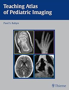 Teaching Atlas of Pediatric Imaging (Teaching Atlas Series) by Paul Babyn