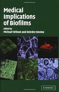 Medical Implications of Biofilms