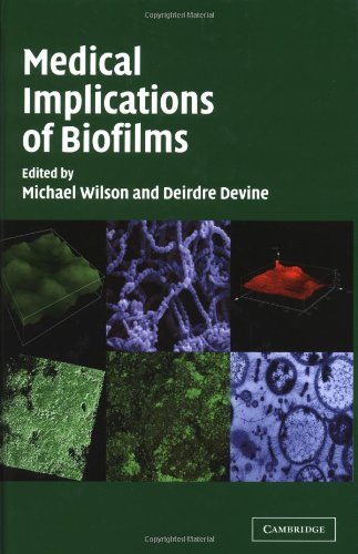 Medical Implications of Biofilms by Michael Wilson