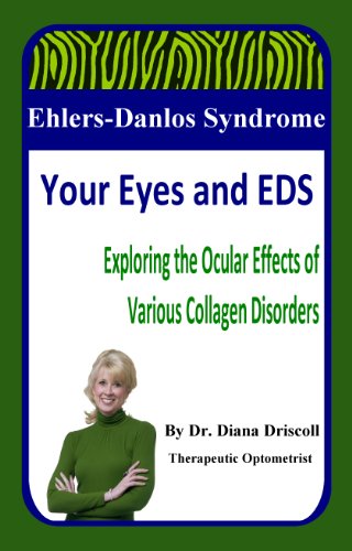 Algopix Similar Product 5 - EhlersDanlos Syndrome Your Eyes and