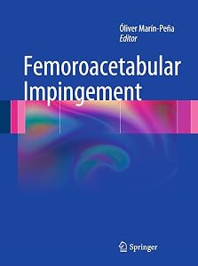 Femoroacetabular Impingement by &Oacute;liver Mar&iacute;n-Pe&ntilde;a