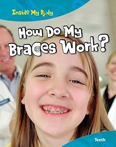 How Do My Braces Work?: Teeth
