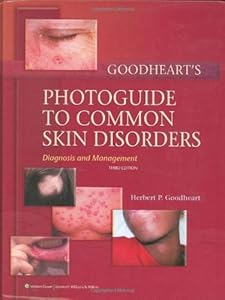 Goodheart's Photoguide to Common Skin Disorders: Diagnosis and Management by M.D. Goodheart, Herbert P.