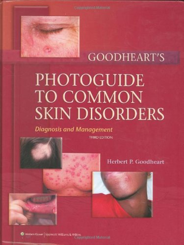 Goodheart's Photoguide to Common Skin Disorders: Diagnosis and Management by M.D. Goodheart, Herbert P.