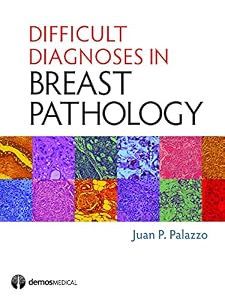 Difficult Diagnoses in Breast Pathology by Juan P. Palazzo MD
