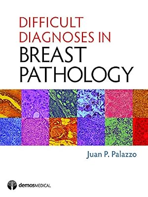 Difficult Diagnoses in Breast Pathology