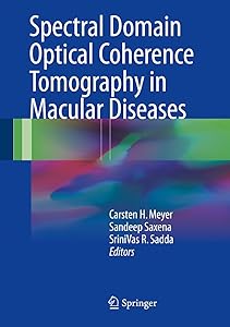 Spectral Domain Optical Coherence Tomography in Macular Diseases by Carsten H. Meyer