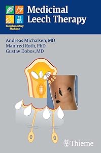 Medicinal Leech Therapy by Andreas Michalsen