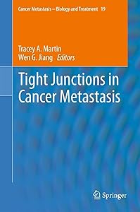 Tight Junctions in Cancer Metastasis (Cancer Metastasis - Biology and Treatment, 19) by Tracey A. Martin