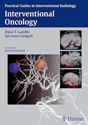 Interventional Oncology (Practical Guides in Interventional Radiology)
