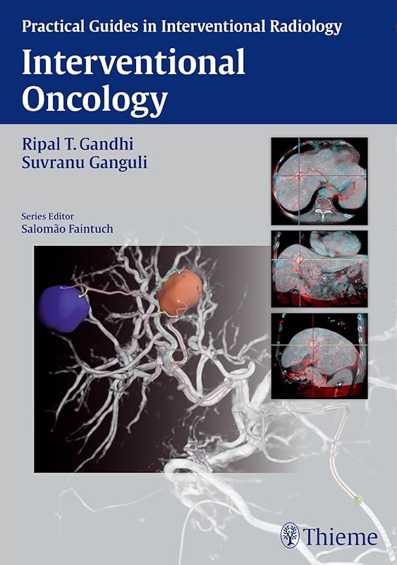 Interventional Oncology (Practical Guides in Interventional Radiology) by Ripal Gandhi