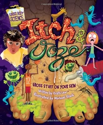 Itch & Ooze: Gross Stuff on Your Skin (Gross Body Science)