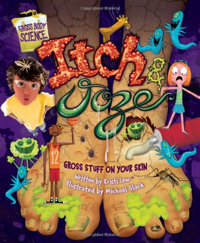 Itch & Ooze: Gross Stuff on Your Skin (Gross Body Science) by Kristi Lew