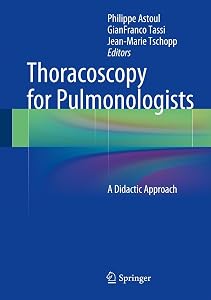 Thoracoscopy for Pulmonologists: A Didactic Approach by Philippe Astoul