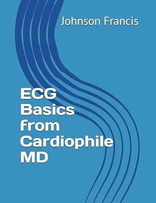 ECG Basics from Cardiophile MD