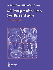 MRI Principles of the Head, Skull Base and Spine by C. Outin B. Soussi J. C. Tamraz