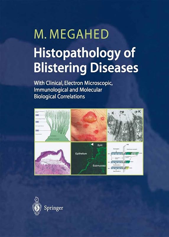 Histopathology of Blistering Diseases: With Clinical, Electron Microscopic, Immunological and Molecular Biological Correlations Textbook and Atlas by Mosaad Megahed