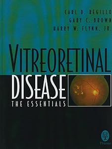 Vitreoretinal Disease: The Essentials by Carl D. Regillo