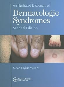 An Illustrated Dictionary of Dermatologic Syndromes by Susan B. Mallory