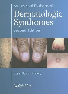 An Illustrated Dictionary of Dermatologic Syndromes