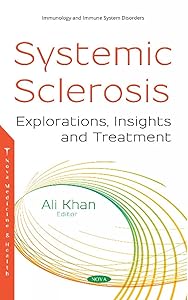 Systemic Sclerosis: Explorations, Insights and Treatment by Ali Khan