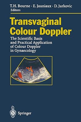 Transvaginal Colour Doppler: The Scientific Basis and Practical Application of Colour Doppler in Gynaecology