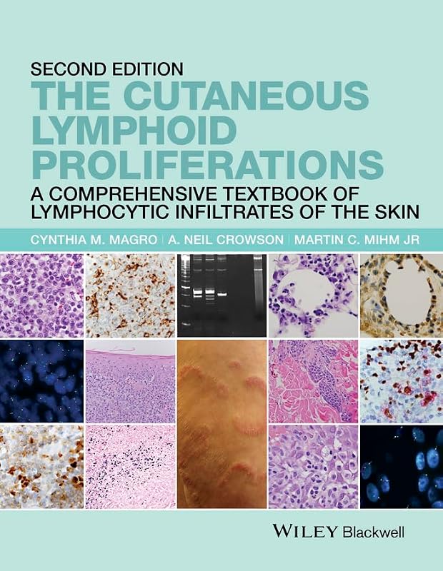 The Cutaneous Lymphoid Proliferations: A Comprehensive Textbook of Lymphocytic Infiltrates of the Skin by Cynthia M. Magro